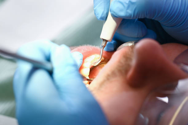 Best Holiday Emergency Dentist in Oak Leaf, TX
