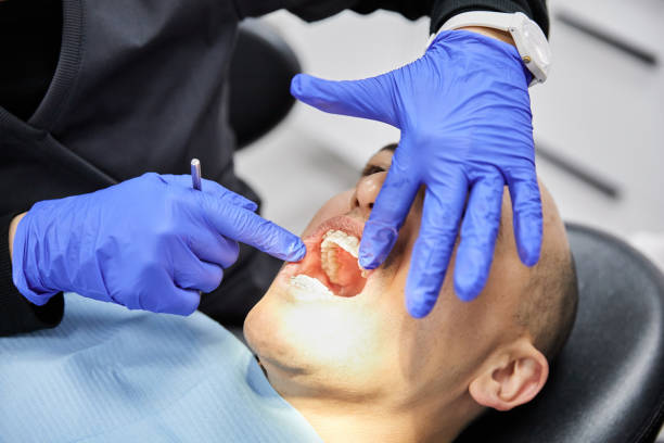 Best Emergency Dentist for Knocked-Out Tooth in Oak Leaf, TX